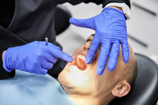 Best Emergency Dental Care for Broken or Chipped Teeth in Mosinee, WI